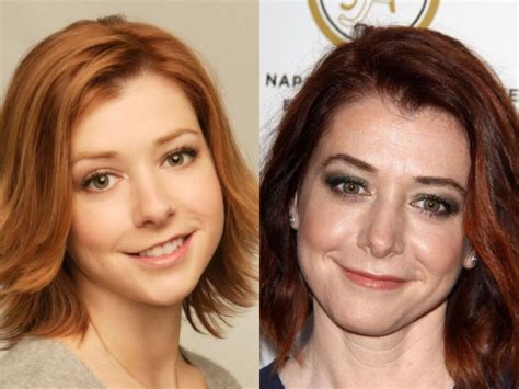 alyson hannigan plastic surgery|Alyson Hannigan Shares Before.